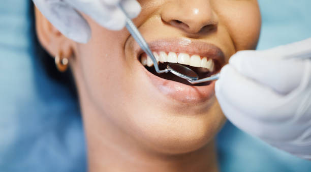 Best Emergency Broken Tooth Repair in Cochranton, PA