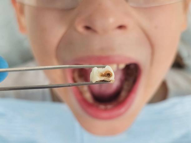Best Pediatric Emergency Dentist in Cochranton, PA